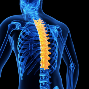 Spine Solutions