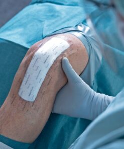 Mepilex Border Post-Op - Image 3