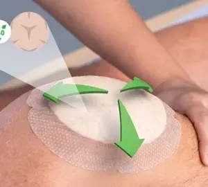 Mepilex Border Flex - Image 7